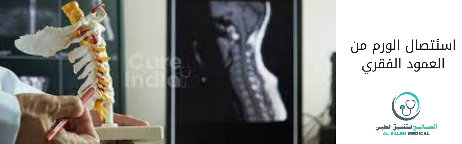 عملية استئصال ورم في العمود الفقري في الهند